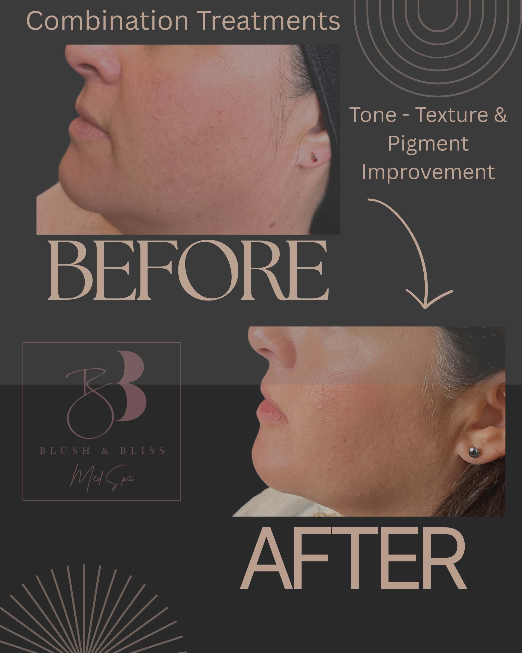 Before and after med spa photos