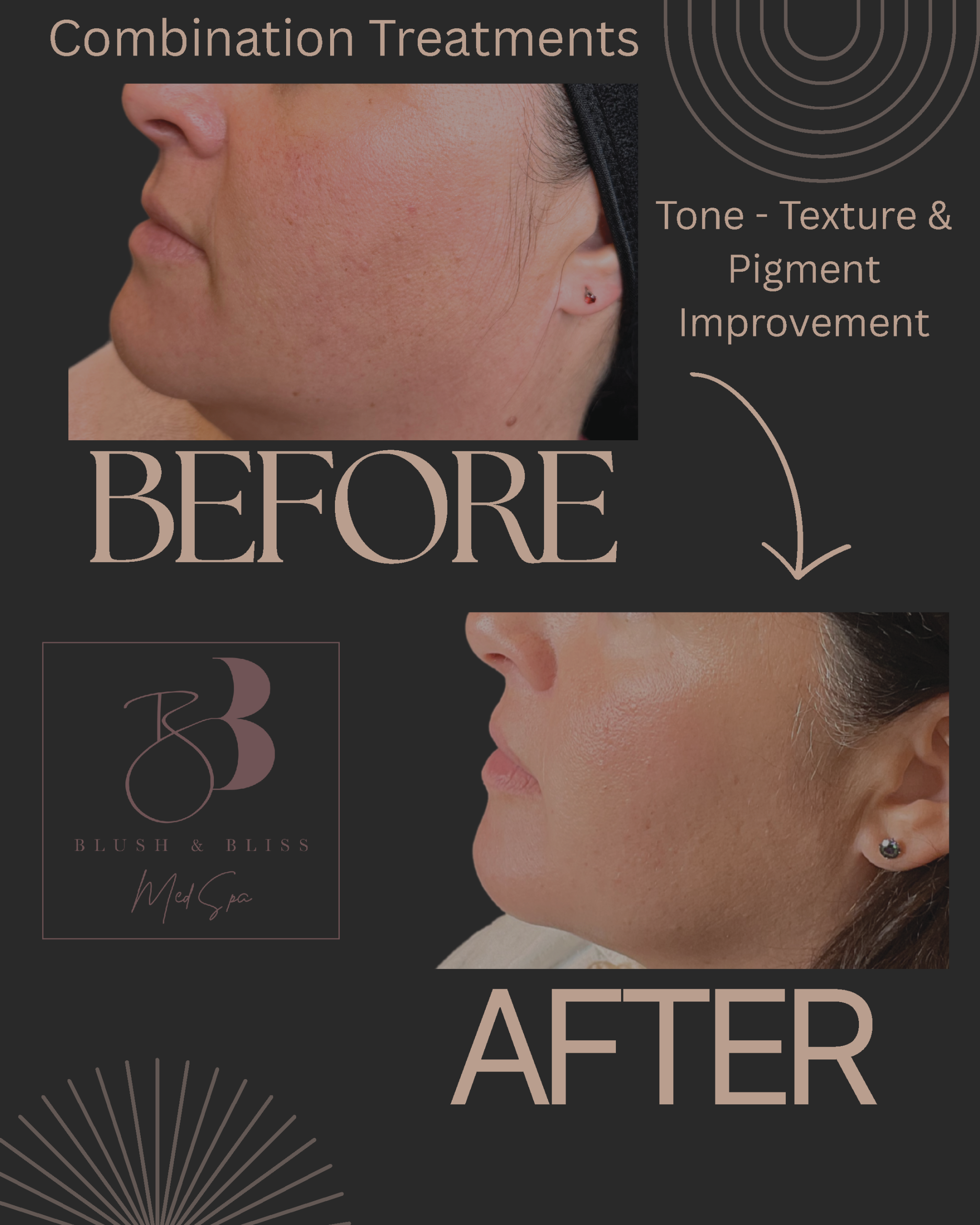 Before and after med spa photos